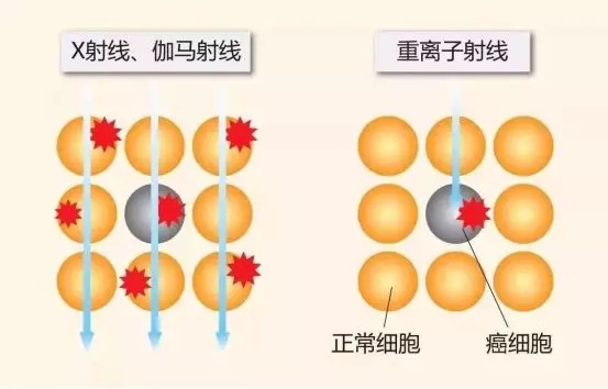 質(zhì)子重離子技術(shù)醫(yī)療險可以報銷嗎？